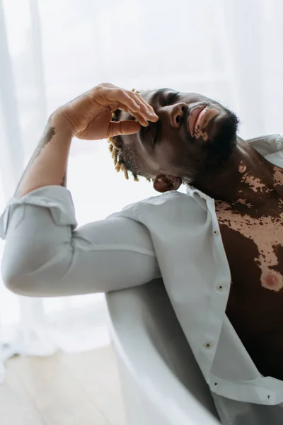 Junger Afrikanisch Amerikanischer Mann Mit Vitiligo Hemd Sitzt Hause Der — Stockfoto