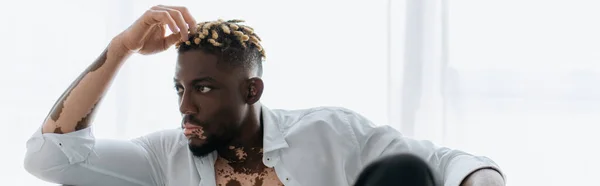 Ung Afrikansk Amerikansk Man Med Vitiligo Medan Skjortan Sitter Badkar — Stockfoto