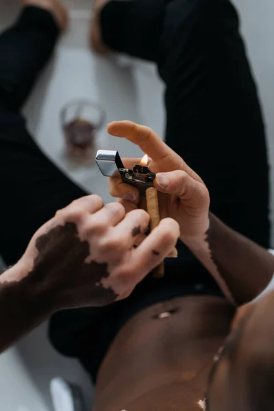 Vista Recortada Del Hombre Afroamericano Con Vitiligo Sosteniendo Encendedor Cigarro — Foto de Stock