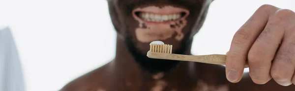 Gehakt Uitzicht Glimlachende Afrikaanse Amerikaanse Man Met Vitiligo Houden Tandenborstel — Stockfoto