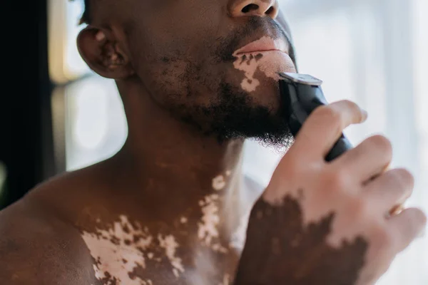 Cropped View African American Man Vitiligo Shaving Electric Razor Morning — Stock Photo, Image