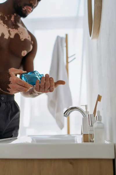 Vista Recortada Del Hombre Afroamericano Con Vitiligo Sosteniendo Loción Aftershave —  Fotos de Stock