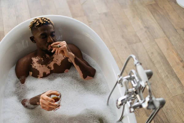 Top view of young african american man with vitiligo smoking cigar and holding glass of bourbon in bath with foam
