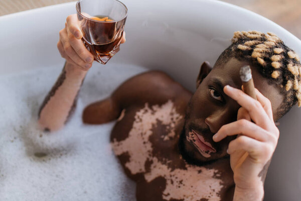 Вид сверху африканца с витилиго, который смотрит в камеру, держа в руках сигару и виски в ванне с пеной 