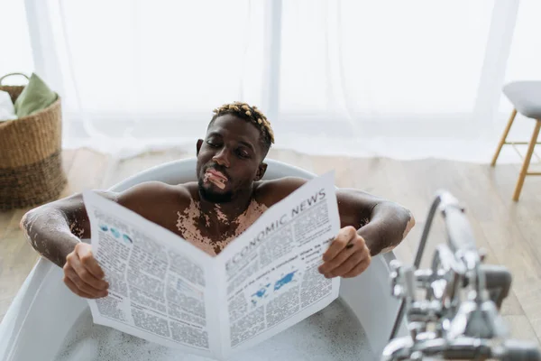 Young African American Man Vitiligo Reading Economic Newspaper While Taking — Stock Photo, Image