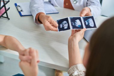 lesbian couple taking ultrasound of their baby from gynecologist, in vitro fertilization concept clipart