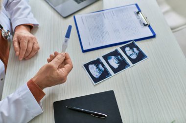 Jinekoloğun elinde hastasının ultrasonu ve lV konsepti olan gebelik testi var.