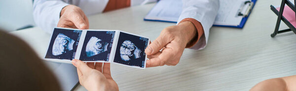 doctor showing lgbt couple their ultrasound of baby, in vitro fertilization concept, banner