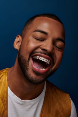 cheerful young man with beard and braces laughing with closed eyes at camera, fashion concept clipart