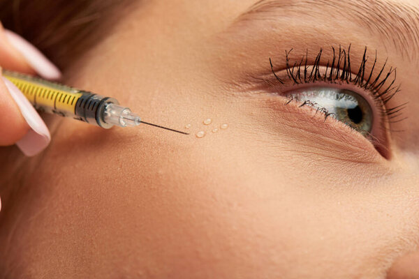 close up of syringe with hyaluronic acid or filler near face of young woman on grey background