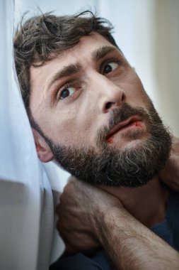 Tişörtlü kaygılı bir adam sinir krizi, ruh sağlığı ve kan kaybından ölene kadar dudaklarını ısırıyor.