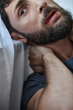 Tişörtlü kaygılı bir adam sinir krizi, ruh sağlığı ve kan kaybından ölene kadar dudaklarını ısırıyor.