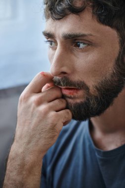 Tişörtlü umutsuz bir adam sinir krizi, ruh sağlığı ve kan kaybından ölene kadar dudaklarını ısırıyor.
