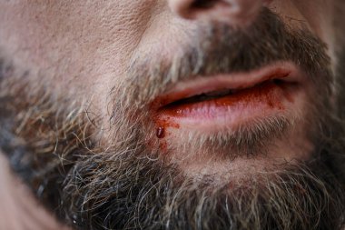 cropped view of anxious man with beard biting his lips till blood during depressive episode clipart