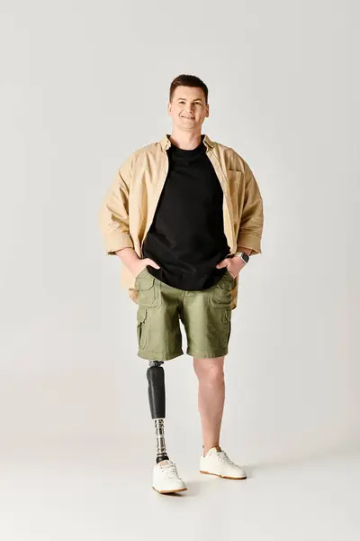 Schöner Mann Mit Beinprothese Der Selbstbewusst Mit Den Händen Auf — Stockfoto