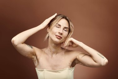 Vitiligo 'su olan genç bir kadın, kolları havada, benzersiz güzelliğini sergiliyor ve bireyselliğini kucaklıyor..