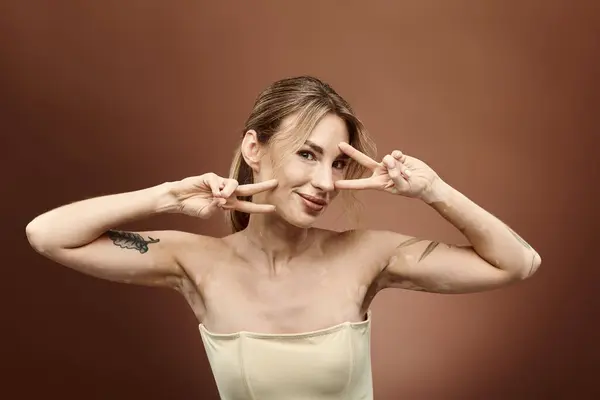 Stock image A young woman with vitiligo poses with a peace sign, her bare shoulders and tattoo visible against a beige background.