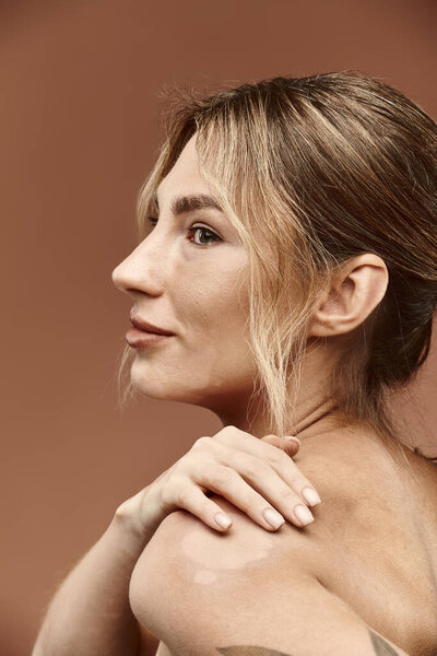 Молодая женщина с витилиго позирует уверенно с голыми плечами на бежевом фоне.