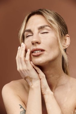 A young woman with vitiligo poses with her bare shoulders and closed eyes on a beige background. clipart