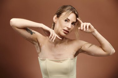 Vitiligo 'su olan genç bir kadın bej arka planda çıplak omuzlarla poz veriyor. Kolunda bir dövme var..