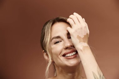 Vitiligo 'su olan genç bir kadın, omuzları bej bir arka planda çıplak poz verirken özgüvenle gülümsüyor..