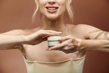 Vitiligo 'su ve dövmesi olan genç bir kadın bej arka planda bir kavanoz krema tutarken gülümsüyor..