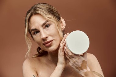 Vitiligo 'su olan genç bir kadın önünde beyaz bir krema kabı tutuyor..