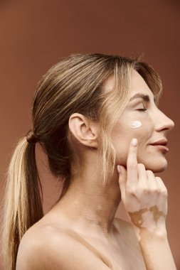 Vitiligo 'su olan genç bir kadın yan tarafa bakarken yüzüne krem sürüyor..