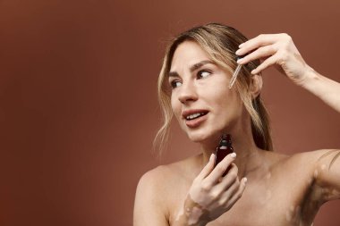 Vitiligo 'su olan genç bir kadın cilt bakım ürününü yüzüne uyguluyor. Gülümsüyor ve mutlu görünüyor..