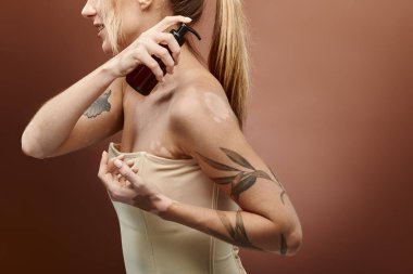 Vitiligo 'su olan genç bir kadın omzuna bej bir arka plan ile cilt kremi sürüyor..