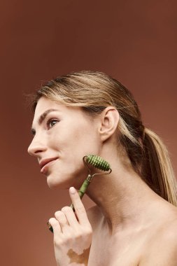 Vitiligo 'su olan genç bir kadın, bej bir arka plana karşı cildinde yeşim bir silindir kullanıyor..