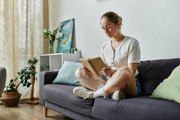 Женщина с витилиго расслабляется и читает книгу на уютном диване.