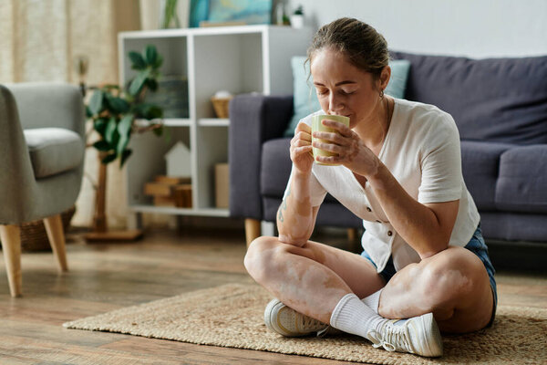A woman with vitiligo sips a comforting beverage while sitting on the floor.