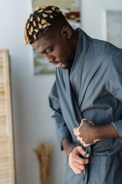 Giovane uomo africano americano con la vitiligine indossa vestaglia a casa — Foto stock