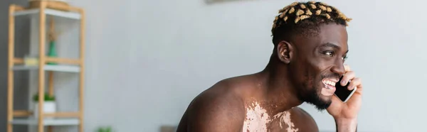 Homme afro-américain souriant et torse nu avec vitiligo parlant sur smartphone à la maison, bannière — Photo de stock