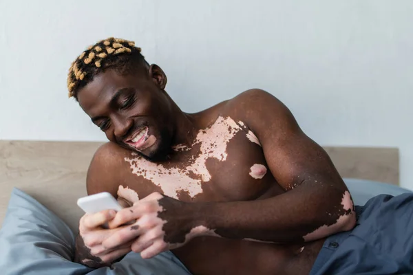 Shirtless african american man with vitiligo using smartphone and smiling in bedroom — Stock Photo