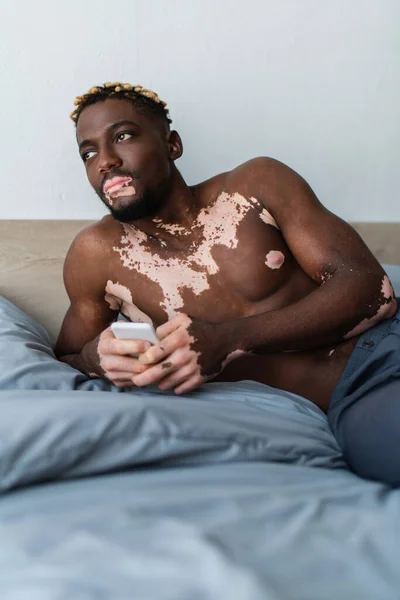 Shirtless african american man with vitiligo holding smartphone while lying on bed — Stock Photo