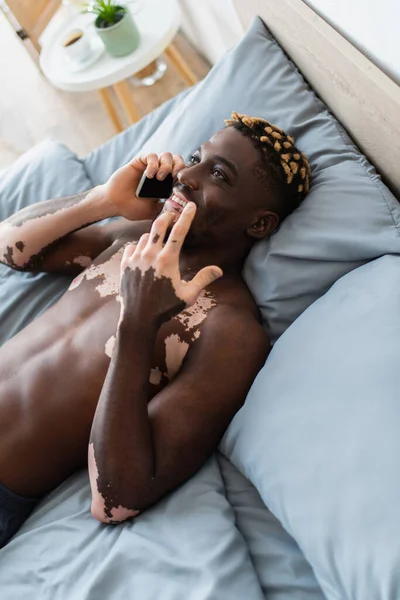 Vista de ángulo alto del hombre americano africano alegre con vitiligo hablando en el teléfono inteligente en la cama - foto de stock