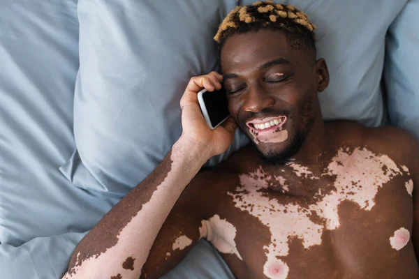 Vista superior del hombre afroamericano sonriente y sin camisa con vitiligo hablando en el teléfono inteligente en la cama - foto de stock