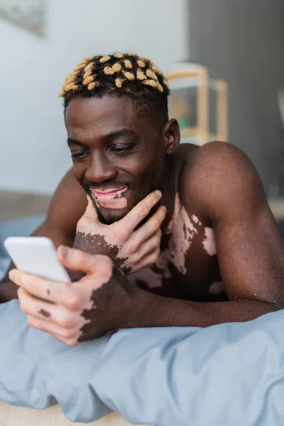 Carefree african american man with vitiligo using cellphone while lying on bed — Stock Photo