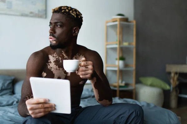 Sans chemise homme afro-américain avec vitiligo tenant tasse de café et tablette numérique sur le lit — Photo de stock