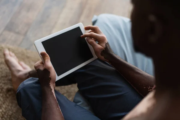 Vista recortada del hombre afroamericano con vitiligo usando tableta digital con pantalla en blanco en el dormitorio - foto de stock
