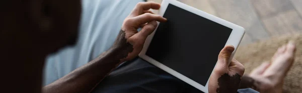 Cropped view of african american man with vitiligo holding digital tablet with blank screen at home, banner — Stock Photo
