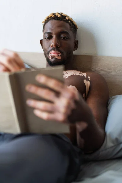 Безсоромний афроамериканець з вітиліго читає невиразну книжку на ліжку. — стокове фото