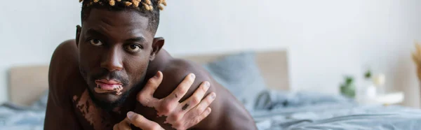 Африканский мужчина без рубашки с витилиго смотрит на камеру в спальне утром, баннер — стоковое фото