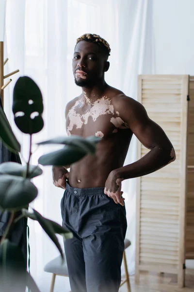 Hombre afroamericano sin camisa con vitiligo de pie cerca de la planta en casa - foto de stock