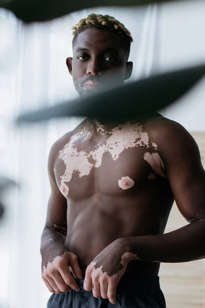 Musculoso hombre afroamericano con vitiligo mirando a la cámara cerca de la planta borrosa en casa - foto de stock