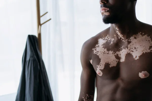 Vista cortada do homem americano africano sem camisa com vitiligo em pé perto do cabide borrado em casa — Fotografia de Stock