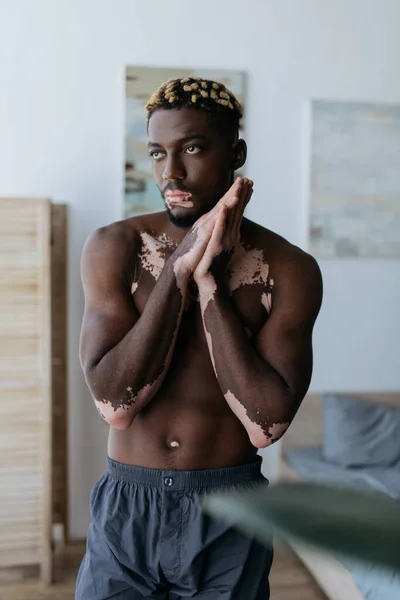 Hombre afroamericano sin camisa con vitiligo de pie con las manos dobladas en el dormitorio borroso en casa - foto de stock