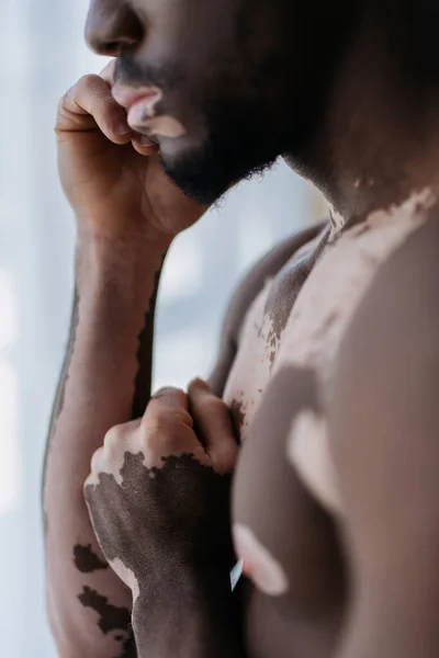 Vista recortada del hombre afroamericano sin camisa con vitiligo de pie en casa - foto de stock